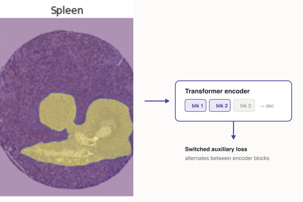 Histopathology tissue patch segmented by a transformer with switched auxiliary loss